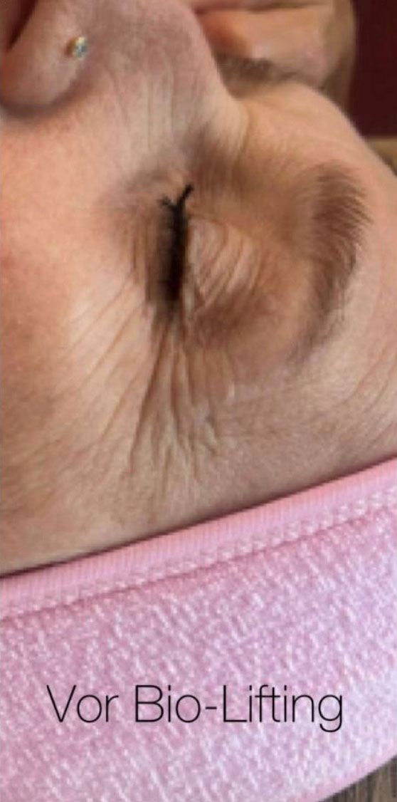 Biofacelifting Anja Haubold